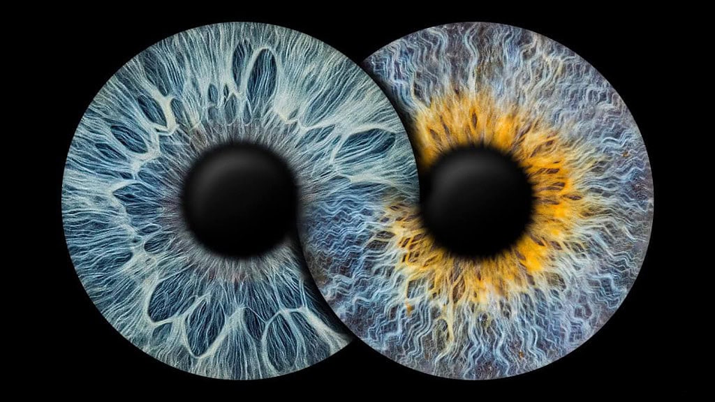 2 Iriden in Form des Unendlichkeitszeichens